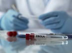 Le sperimentazioni umane sul vaccino contro l'Ebola inizieranno presto nel Regno Unito
